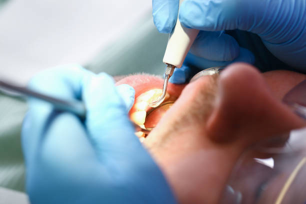 Best Emergency Treatment for Toothache in Caldwell, TX